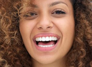 Clareamento Dental em Presidente Prudente